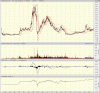 big.chart2.gif