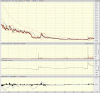 big.chart.gif